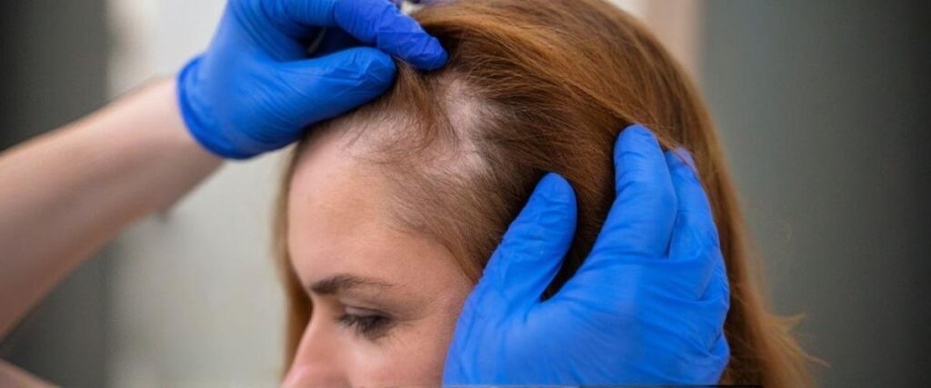 Imagem de uma mulher com queda de cabelo sendo examinada por uma dermatologista em uma clínica.